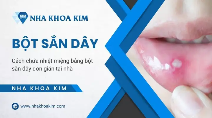 Cách Nấu Bột Sắn Dây Trị Nhiệt Miệng: Hướng Dẫn Chi Tiết Và Những Lưu Ý Quan Trọng