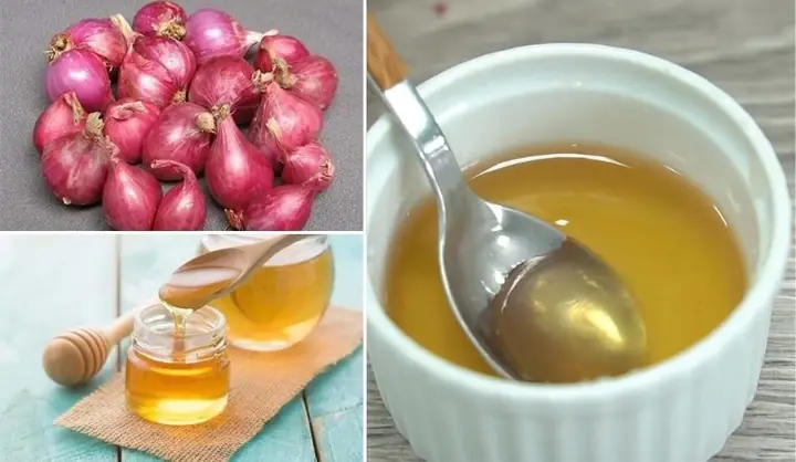 Hành Tím Trộn Mật Ong: Công Thức Vàng Cho Sức Khỏe Và Làm Đẹp