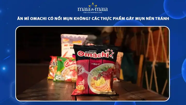 Mì Omachi Có Nóng Không? Giải Đáp Chi Tiết Và Những Điều Bạn Cần Biết Mì Omachi Có Nóng Không? Giải Đáp Chi Tiết Và Những Điều Bạn Cần Biết