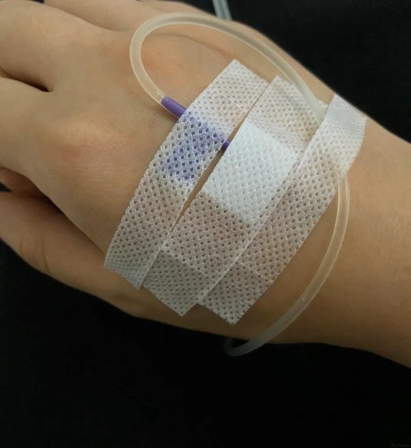 78+ Truyền nước tại nhà ảnh thật được nhiều người tìm kiếm truyền nước tại nhà ảnh thật 16
